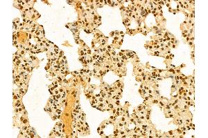 ABIN7094285 and ABIN7098332 at 1/100 staining Rat lung tissue by IHC-P. (HP1BP3 Antikörper  (Internal Region))