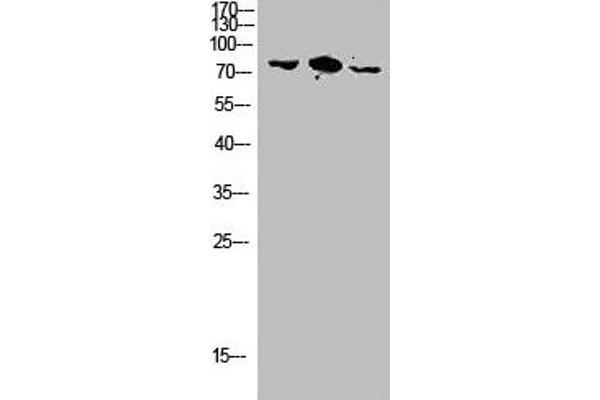 RHOBTB3 Antikörper  (Internal Region)