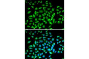 Immunofluorescence analysis of U2OS cells using MECP2 antibody (ABIN6134134, ABIN6143680, ABIN6143682 and ABIN6217279). (MECP2 Antikörper  (AA 1-100))