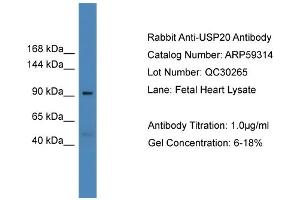 WB Suggested Anti-USP20  Antibody Titration: 0. (USP20 Antikörper  (Middle Region))