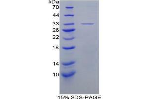 SDS-PAGE analysis of Mouse EIF3A Protein. (EIF6 Protein)