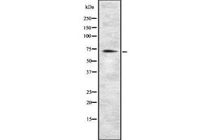 Western blot analysis of MIC1 using HeLa whole cell lysates (C18orf8 Antikörper  (C-Term))