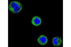 Confocal immunofluorescent analysis of CD1E Antibody (Center)(Cat#AP50840PU-N) with MDA-MB435 cell followed by Alexa Fluor 488-conjugated goat anti-rabbit lgG (green). (CD1e Antikörper  (Middle Region))