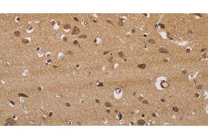 Immunohistochemistry (Paraffin-embedded Sections) (IHC (p)) image for anti-Inositol 1,4,5-Trisphosphate Receptor, Type 3 (ITPR3) antibody (ABIN7239113)