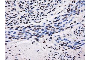 Immunohistochemistry (IHC) image for anti-Sorbitol Dehydrogenase (SORD) antibody (ABIN1501077) (SORD Antikörper)