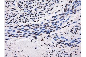 Immunohistochemistry (IHC) image for anti-Sorbitol Dehydrogenase (SORD) antibody (ABIN1501077)
