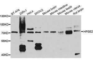 Western blot analysis of extracts of various cell lines, using HPSE2 antibody. (Heparanase 2 Antikörper  (AA 42-242))