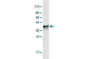 Western Blot detection against Immunogen (36. (TREH Antikörper  (AA 25-124))