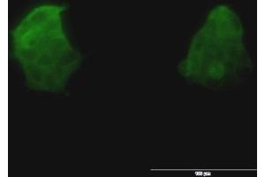 Immunofluorescence of monoclonal antibody to TSPAN8 on 293 cell.