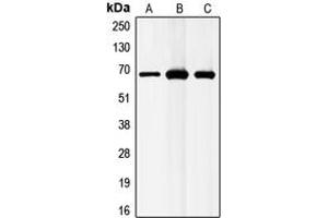 Western blot analysis of GABRB1 expression in MCF7 (A), mouse liver (B), rat liver (C) whole cell lysates.