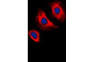 Immunofluorescent analysis of VEGFR2 (pY1175) staining in MCF7 cells. (VEGFR2/CD309 Antikörper  (C-Term, pTyr1175))