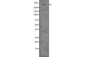 Western blot analysis of PLEC using Jurkat whole  lysates. (PLEC Antikörper  (N-Term))