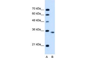 Western Blotting (WB) image for anti-Activin A Receptor, Type IIB (ACVR2B) antibody (ABIN2462828) (ACVR2B Antikörper)