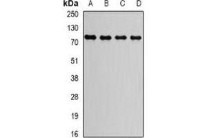 Western blot analysis of GGA2 expression in HepG2 (A), Raji (B), MCF7 (C), mouse brain (D) whole cell lysates.