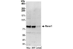 Western Blotting (WB) image for anti-Ribonucleoprotein, PTB-Binding 1 (RAVER1) (AA 556-606) antibody (ABIN7451021)