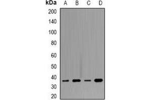 Western blot analysis of Tropomyosin expression in SW480 (A), MCF7 (B), mouse heart (C), mouse brain (D) whole cell lysates.
