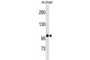 ZN Antibody (C-term) (ABIN1882039 and ABIN2838997) western blot analysis in mouse liver tissue lysates (35 μg/lane). (ZNF865 Antikörper  (C-Term))
