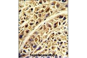 Immunohistochemistry (Paraffin-embedded Sections) (IHC (p)) image for anti-Proline Arginine Rich End Leucine Rich Repeat Protein (PRELP) (AA 257-286), (C-Term) antibody (ABIN390612)