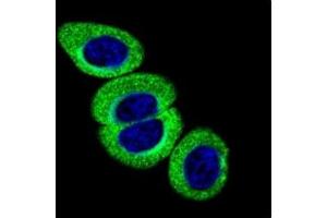 Confocal immunofluorescent analysis of phospho-ATM antibody with HeLa cells followed by Alexa Fluor 488-conjugated goat anti-rabbit lgG (green). (ATM Antikörper  (pSer1981))