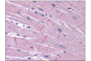 Human Heart: Formalin-Fixed, Paraffin-Embedded (FFPE) (KCNK18 Antikörper)