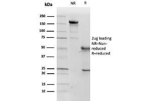 SDS-PAGE Analysis Purified p57 Monoclonal Antibody (KP10). (CDKN1C Antikörper)