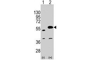 Western blot analysis of SPRED1 polyclonal antibody  (arrow). (SPRED1 Antikörper  (C-Term))
