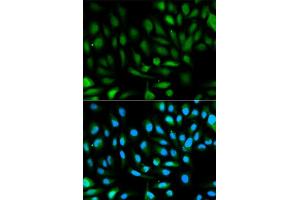 Immunofluorescence analysis of HeLa cell using PARK7 antibody. (PARK7/DJ1 Antikörper  (AA 1-189))