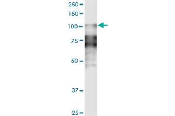 Desmocollin 2 antibody  (AA 444-534)