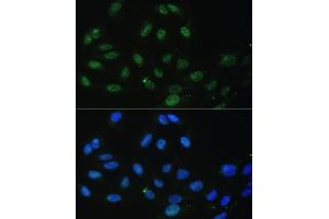 Immunofluorescence analysis of U-2 OS cells using DDX50 antibody (ABIN6129371, ABIN6139509, ABIN6139510 and ABIN6224730) at dilution of 1:100. (DDX50 Antikörper  (AA 1-135))