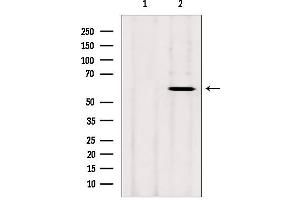 Western blot analysis of extracts from rat heart, using CYP26B1 antibody. (CYP26B1 Antikörper  (Internal Region))