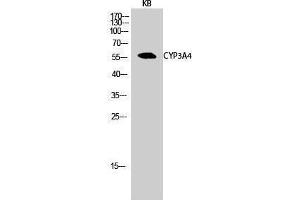 Western Blotting (WB) image for anti-Cytochrome P450, Family 3, Subfamily A, Polypeptide 4 (CYP3A4) (Internal Region) antibody (ABIN3184195)