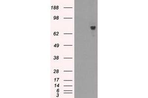 Image no. 5 for anti-Bruton Agammaglobulinemia tyrosine Kinase (BTK) antibody (ABIN1496976) (BTK Antikörper)