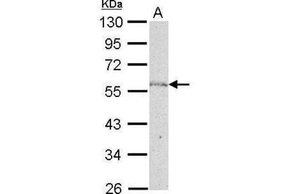 NUP50 Antikörper  (C-Term)