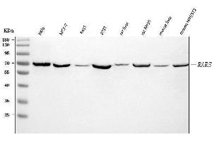 Western blot analysis of RARS/RARS1 using anti-RARS/RARS1 antibody (ABIN7600223). (Probable Arginine--tRNA Ligase, Cytoplasmic (RARS-1) (AA 165-425) Antikörper)