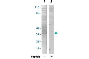 Western blot analysis of extracts from HT-29 cells, using PMEPA1 polyclonal antibody . (PMEPA1 Antikörper)