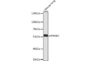 Western blot analysis of extracts of Mouse lung, using P Rabbit pAb (ABIN7269169) at 1:1000 dilution. (PANK2 Antikörper  (AA 300-400))