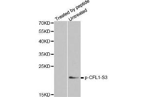 Western blot analysis of extracts from COLO205 cells, using phospho-CFL1-S3 antibody. (Cofilin Antikörper  (pSer3))