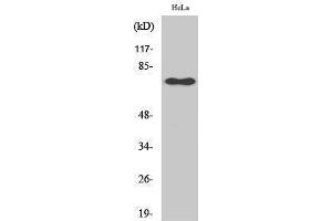 Western Blotting (WB) image for anti-Nuclear Factor-kB p65 (NFkBP65) (pSer529) antibody (ABIN3182089) (NF-kB p65 Antikörper  (pSer529))