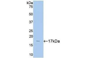 Detection of Recombinant HK1, Human using Polyclonal Antibody to Hexokinase 1 (HK1) (Hexokinase 1 Antikörper  (AA 80-215))