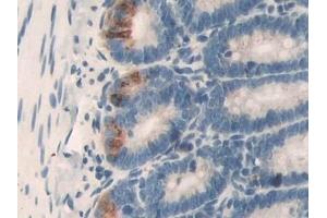 Immunohistochemistry (IHC) image for anti-Dihydrolipoamide Dehydrogenase (DLD) antibody (ABIN7442078)