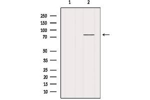 Western blot analysis of extracts from Mouse lung, using MECP2 Antibody. (MECP2 Antikörper  (C-Term))