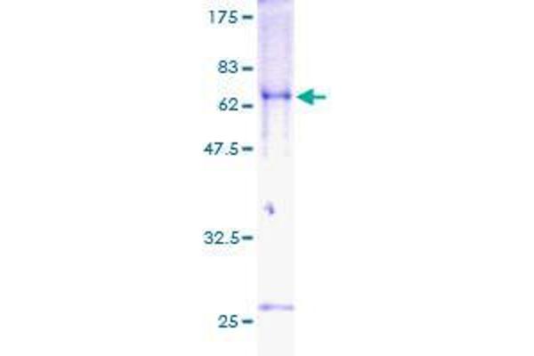 TOB2 Protein (AA 1-344) (GST tag)