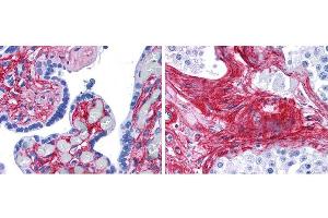 Immunohistochemistry of Rabbit anti-collagen VI antibody. (COL6 Antikörper  (HRP))