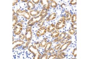 Immunohistochemistry analysis of paraffin-embedded rat duodenum using,STC (ABIN7075723) at dilution of 1: 800 (Stanniocalcin 1 Antikörper)