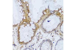 Immunohistochemistry of paraffin-embedded human stomach using GCC2 antibody (ABIN6130422, ABIN6141007, ABIN6141008 and ABIN6217941) at dilution of 1:150 (40x lens). (GCC2 Antikörper  (AA 1-300))