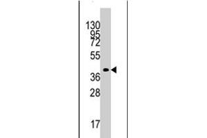 Western blot analysis of TBRG1 polyclonal antibody  in mouse kidney tissue lysates (35 ug/lane). (TBRG1 Antikörper  (N-Term))