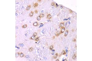 Immunohistochemistry of paraffin-embedded rat brain using RPS3A Antibody. (RPS3A Antikörper  (AA 1-264))