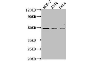 Western Blot Positive WB detected in: MCF-7 whole cell lysate, A549 whole cell lysate, Hela whole cell lysate All lanes: TSKU antibody at 1:2000 Secondary Goat polyclonal to rabbit IgG at 1/50000 dilution Predicted band size: 38 kDa Observed band size: 49 kDa (TSKU Antikörper  (AA 77-353))