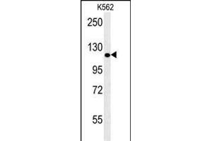 POTEE Antibody (Center) (ABIN653968 and ABIN2843918) western blot analysis in K562 cell line lysates (35 μg/lane). (POTEE Antikörper  (AA 380-409))