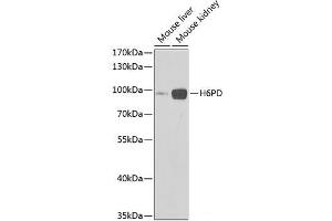 Western blot analysis of extracts of various cell lines using H6PD Polyclonal Antibody at dilution of 1:1000.
